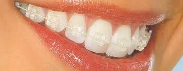 CENTRUL STOMATOLOGIC ZORILOR- DR.TUDOR POMANA - CENTRUL STOMATOLOGIC ZORILOR- DR.TUDOR POMANA