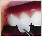 CENTRUL STOMATOLOGIC ZORILOR- DR.TUDOR POMANA - CENTRUL STOMATOLOGIC ZORILOR- DR.TUDOR POMANA