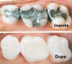 CENTRUL STOMATOLOGIC ZORILOR- DR.TUDOR POMANA - CENTRUL STOMATOLOGIC ZORILOR- DR.TUDOR POMANA