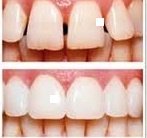 CENTRUL STOMATOLOGIC ZORILOR- DR.TUDOR POMANA - CENTRUL STOMATOLOGIC ZORILOR- DR.TUDOR POMANA