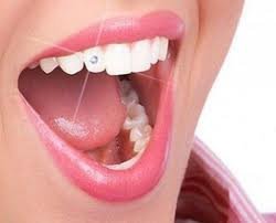 CENTRUL STOMATOLOGIC ZORILOR- DR.TUDOR POMANA - CENTRUL STOMATOLOGIC ZORILOR- DR.TUDOR POMANA