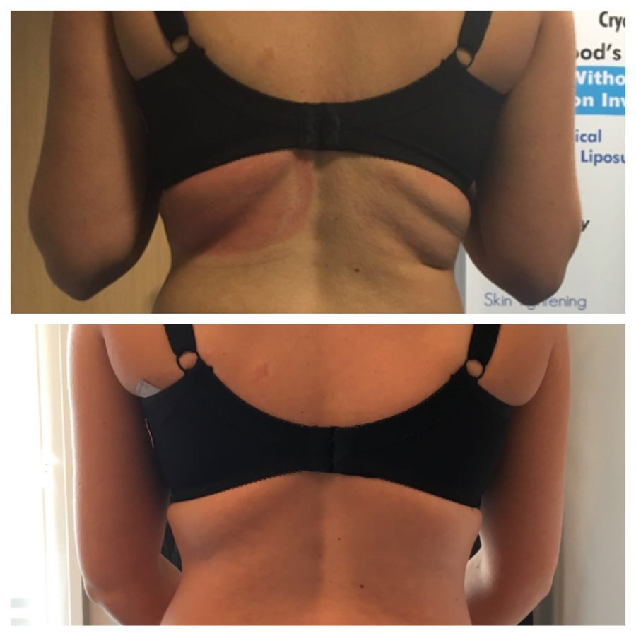 عيادة شيشاير للجسم - Cheshire Body Clinic