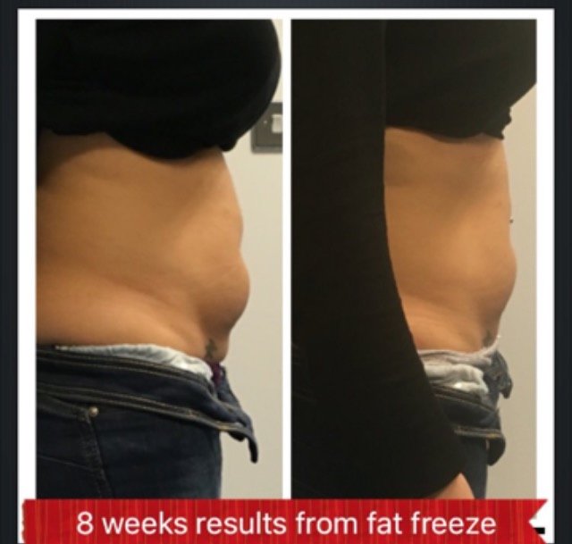 عيادة شيشاير للجسم - Cheshire Body Clinic