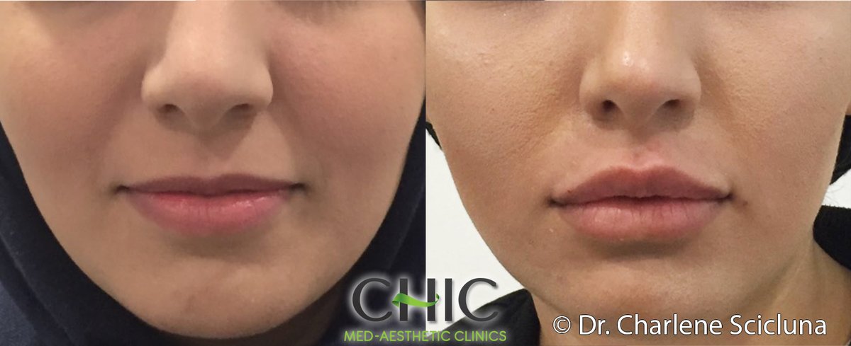 CHIC Med-Aesthetic Clinics - CHIC Med-Aesthetic Clinics