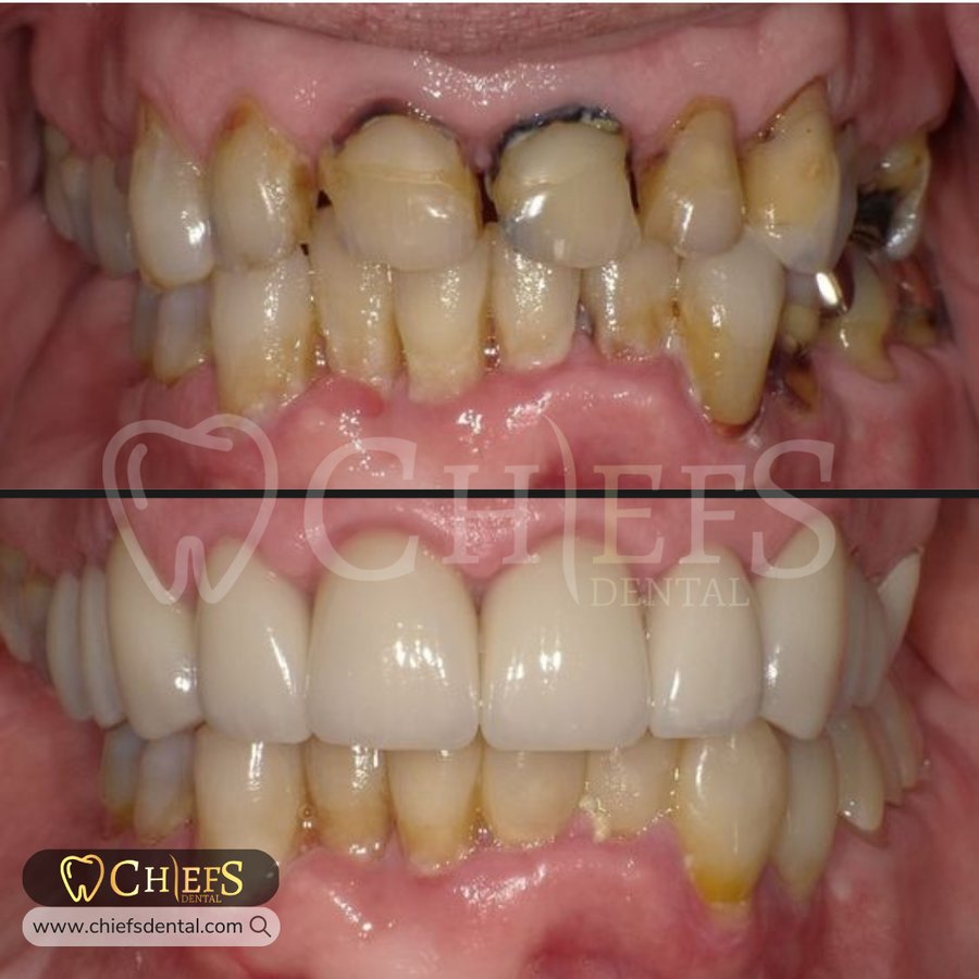 Chiefs Dental - Chiefs Dental