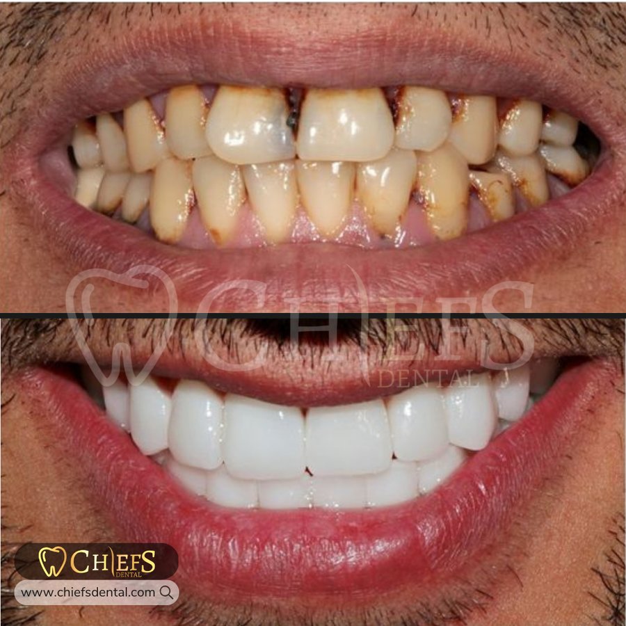 Chiefs Dental - Chiefs Dental