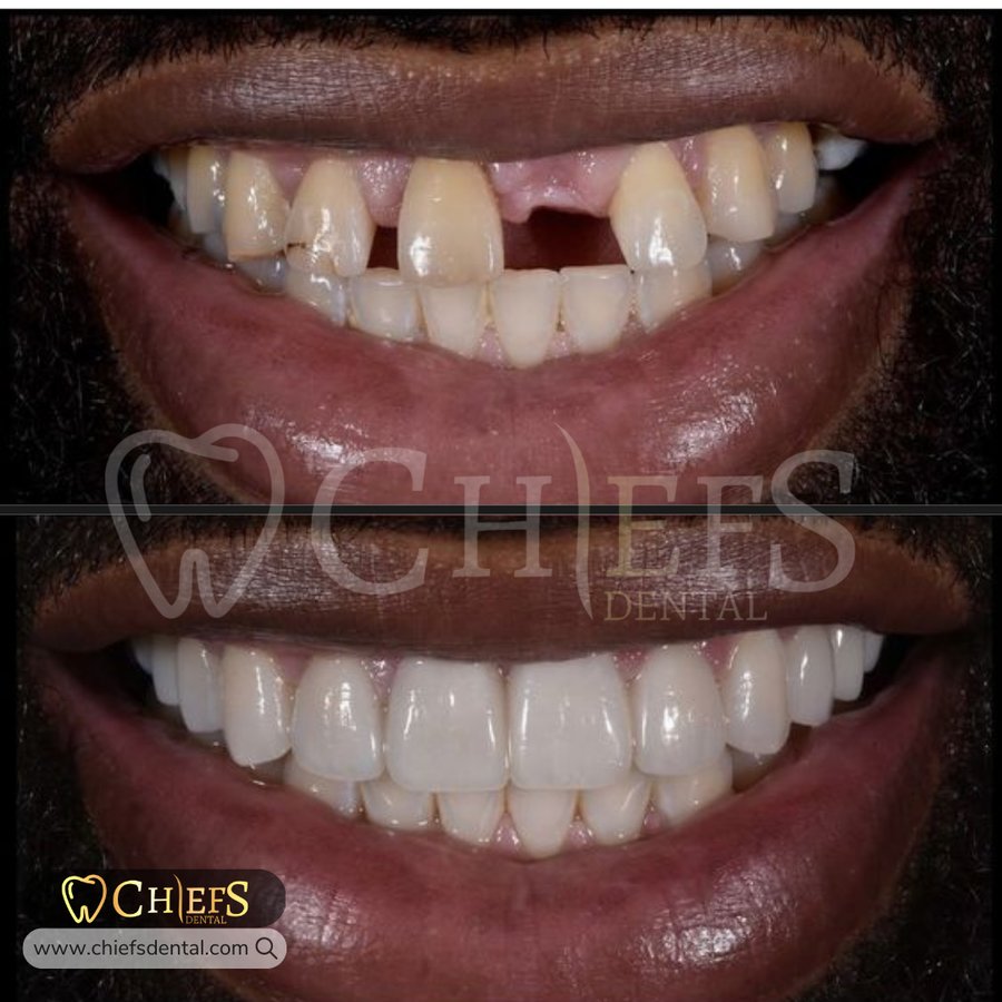 Chiefs Dental - Chiefs Dental