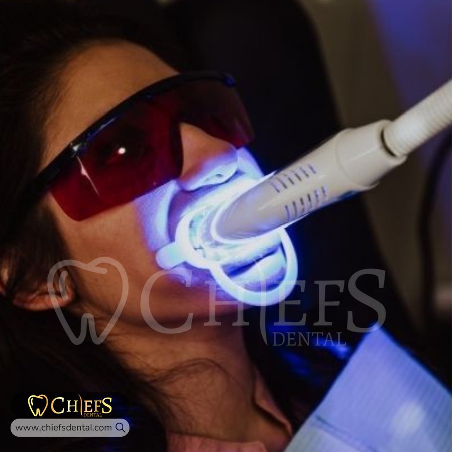 Chiefs Dental - Chiefs Dental