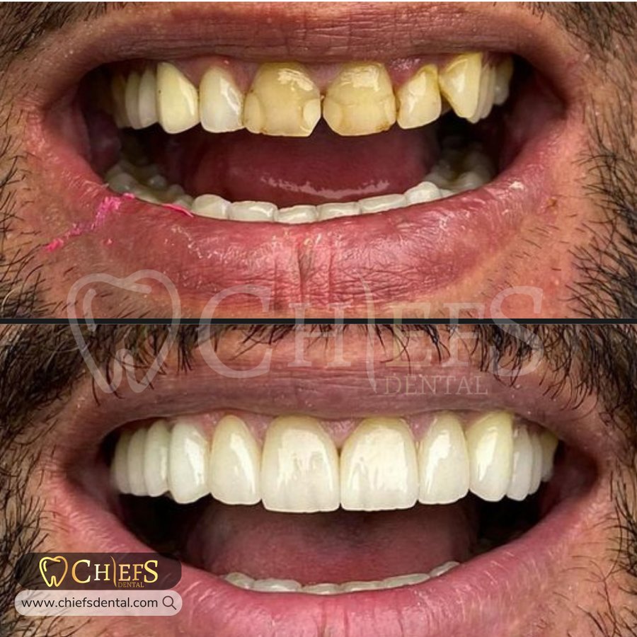 Chiefs Dental - Chiefs Dental