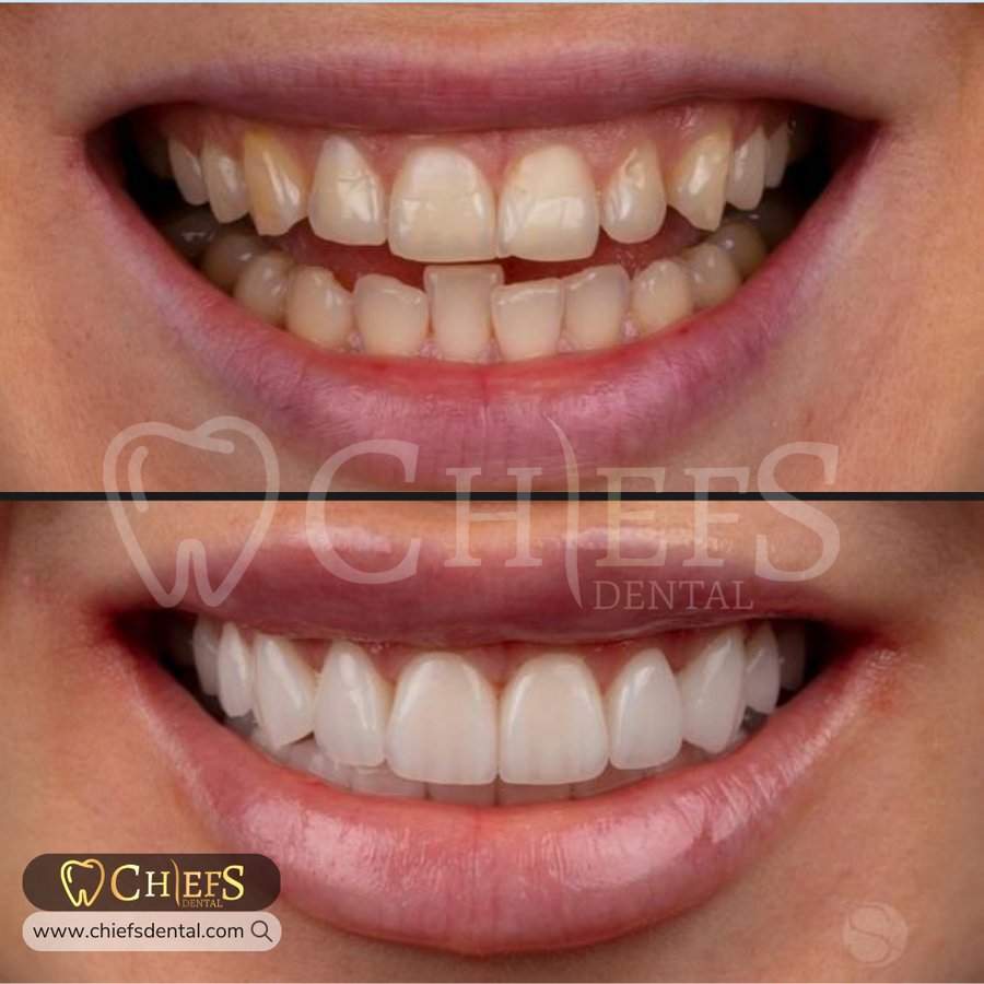 Chiefs Dental - Chiefs Dental