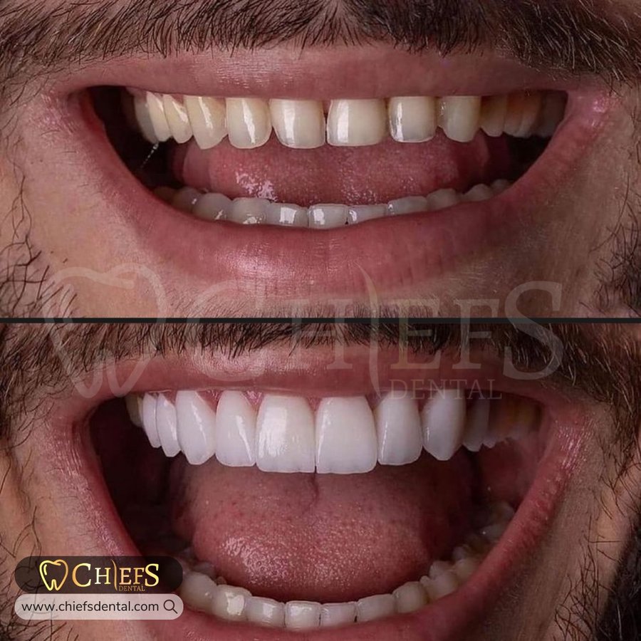 Chiefs Dental - Chiefs Dental