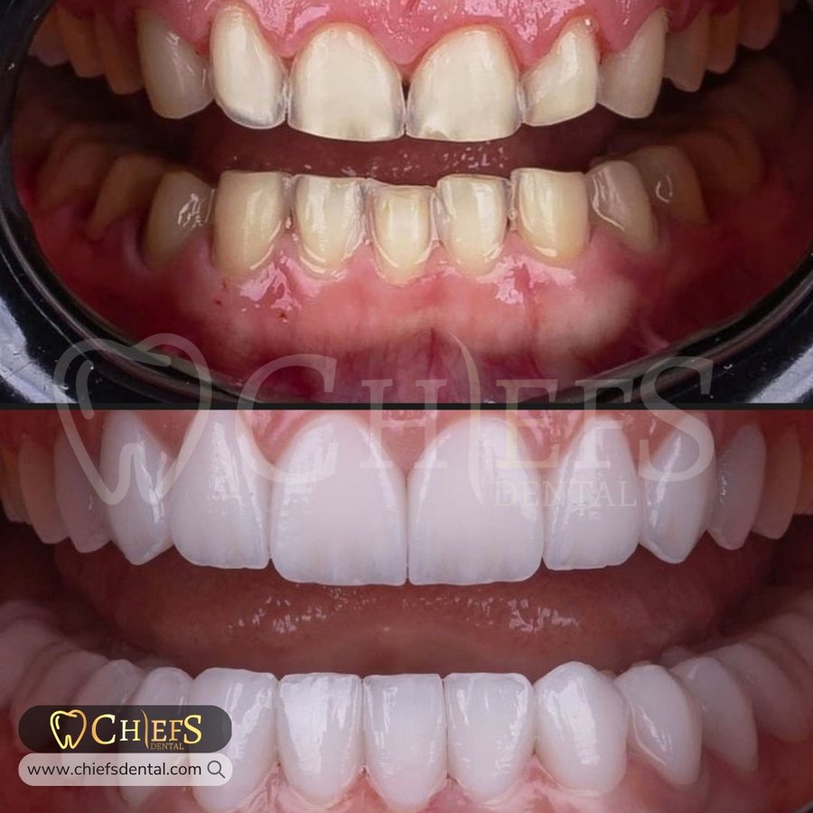 Chiefs Dental - Chiefs Dental