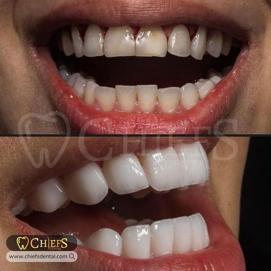 Chiefs Dental - Chiefs Dental