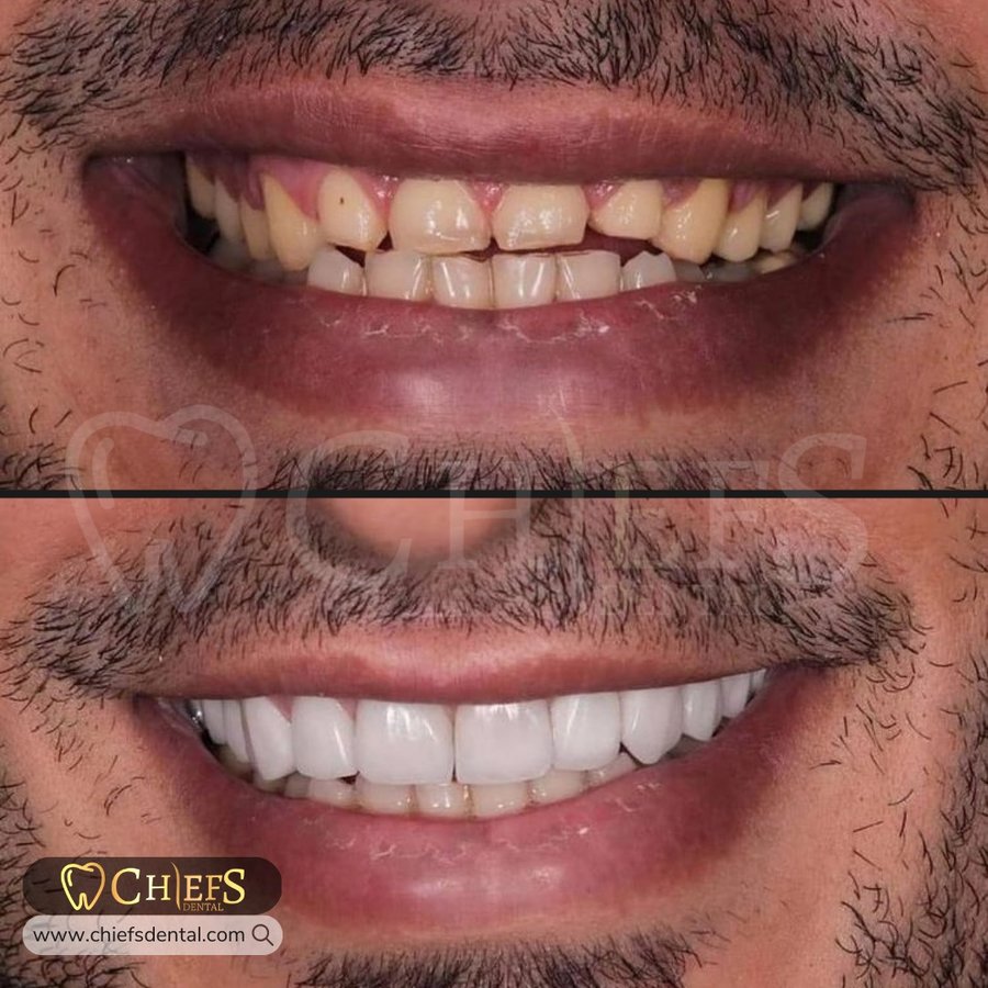 Chiefs Dental - Chiefs Dental