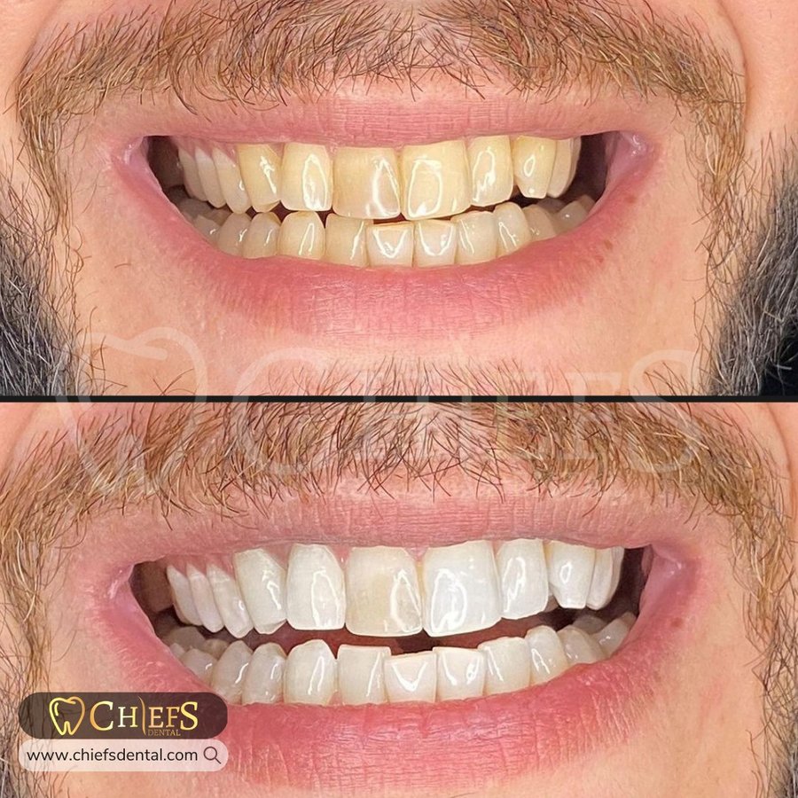 Chiefs Dental - Chiefs Dental