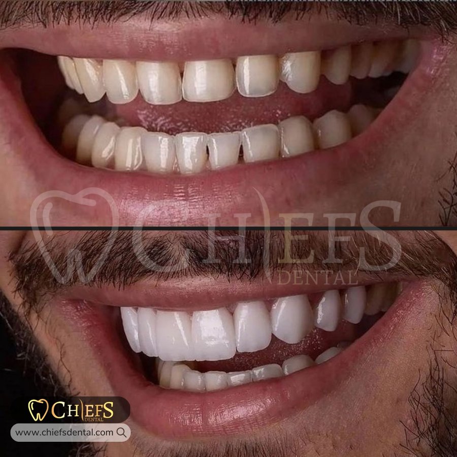 Chiefs Dental - Chiefs Dental