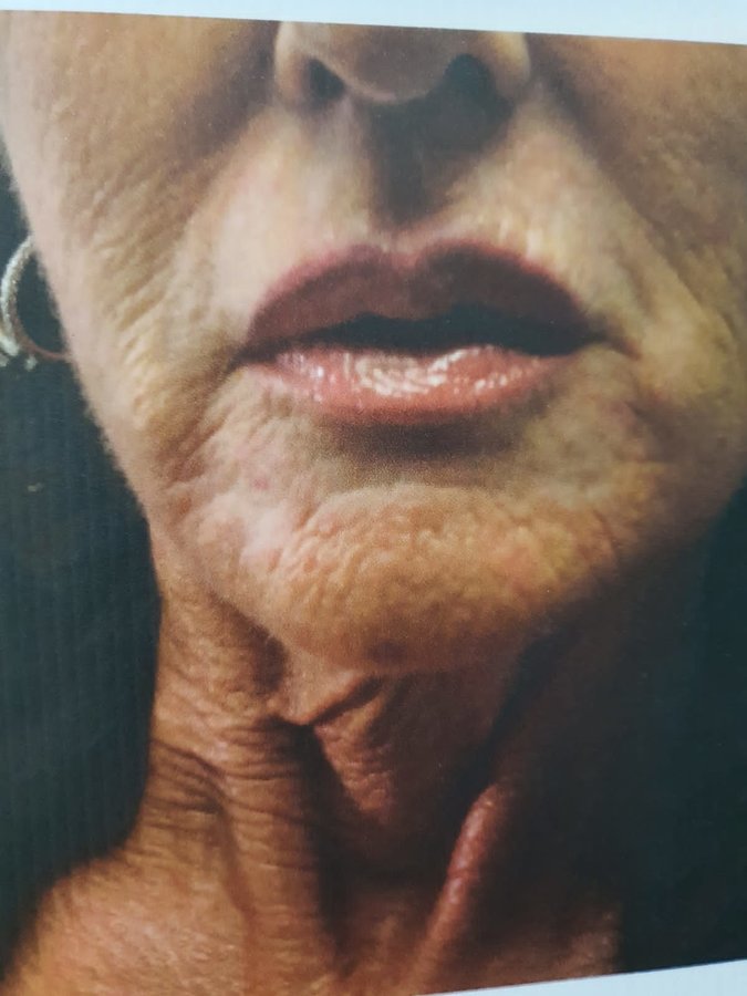 Chinbrook Medical Cosmetic Centre - Chinbrook Medical Cosmetic Centre