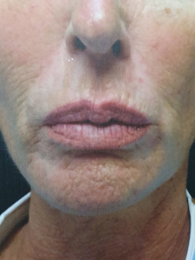 Chinbrook Medical Cosmetic Centre - Chinbrook Medical Cosmetic Centre