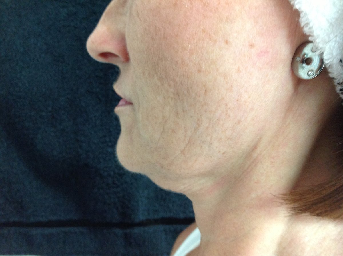 Chinbrook Medical Cosmetic Centre - Chinbrook Medical Cosmetic Centre