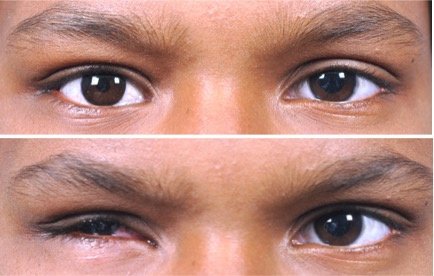 Chinmaya Artificial Eye Clinic - Chinmaya Artificial Eye Clinic