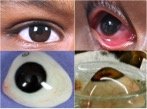 Chinmaya Artificial Eye Clinic - Chinmaya Artificial Eye Clinic