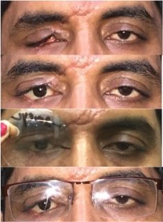 Chinmaya Artificial Eye Clinic - Chinmaya Artificial Eye Clinic