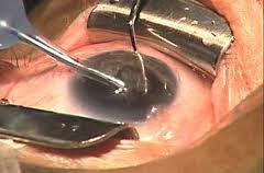 Chinmaya Vision The Eye Hospital - Chinmaya Vision The Eye Hospital