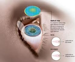 Chinmaya Vision The Eye Hospital - Chinmaya Vision The Eye Hospital