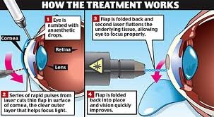 Chinmaya Vision The Eye Hospital - Chinmaya Vision The Eye Hospital