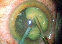 Chinmaya Vision The Eye Hospital - Chinmaya Vision The Eye Hospital