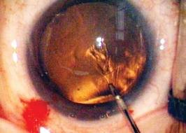 Chinmaya Vision The Eye Hospital - Chinmaya Vision The Eye Hospital