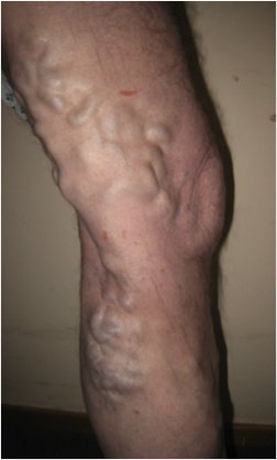 Christchurch Vascular Clinic - Christchurch Vascular Clinic