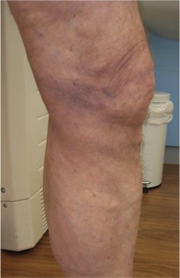 Christchurch Vascular Clinic - Christchurch Vascular Clinic