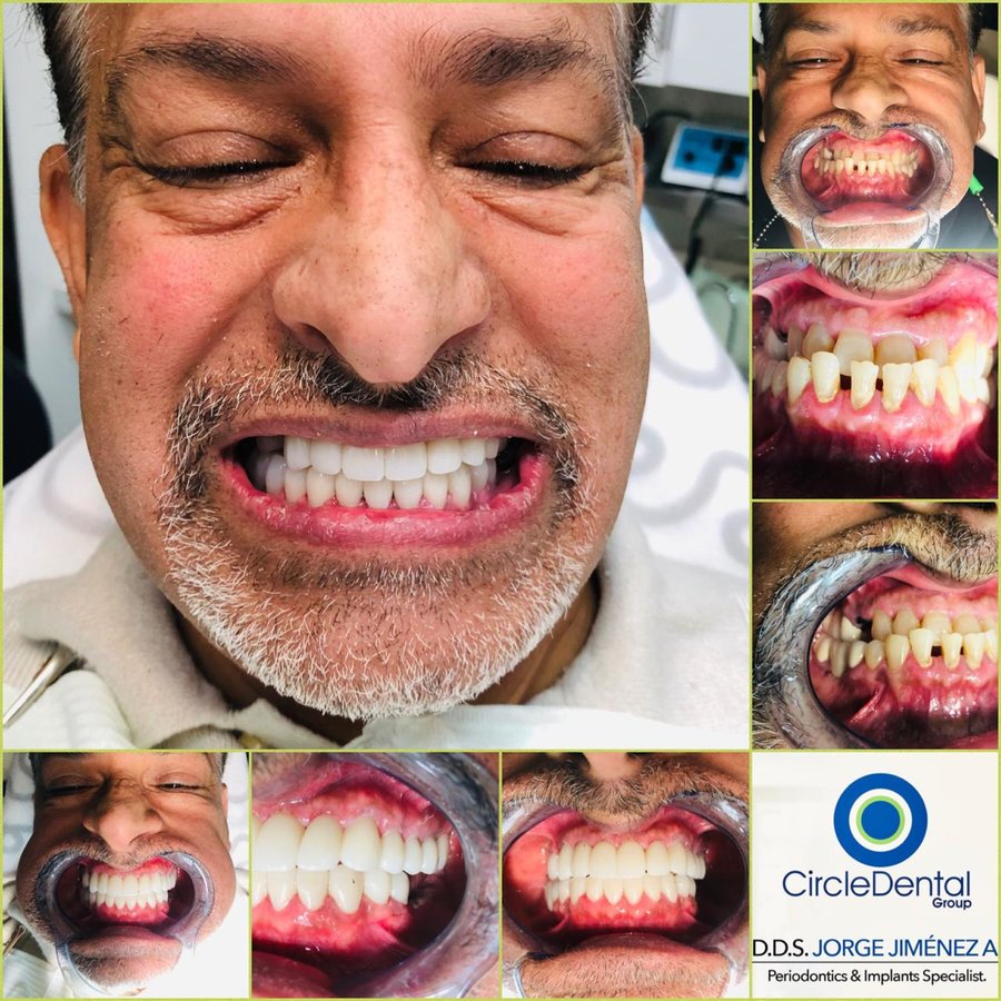 Circle Dental Group - Los Algodones - Circle Dental Group - Los Algodones