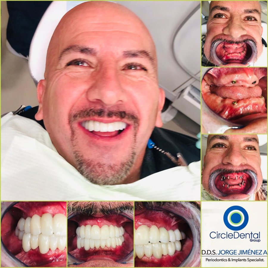 Circle Dental Group - Los Algodones - Circle Dental Group - Los Algodones