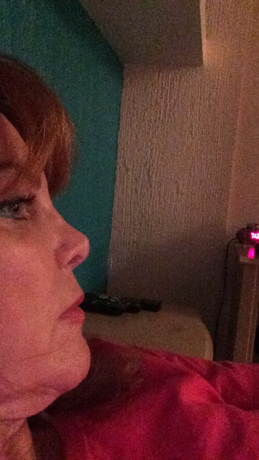 Cirugía Plastica Dr. Miguel Sanchez-Moran - Cirugía Plastica Dr. Miguel Sanchez-Moran