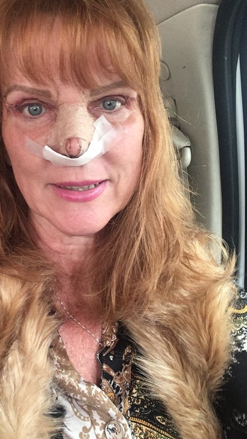 Cirugía Plastica Dr. Miguel Sanchez-Moran - Cirugía Plastica Dr. Miguel Sanchez-Moran