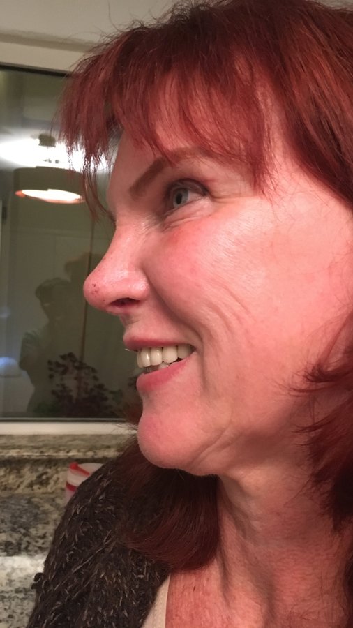 Cirugía Plastica Dr. Miguel Sanchez-Moran - Cirugía Plastica Dr. Miguel Sanchez-Moran