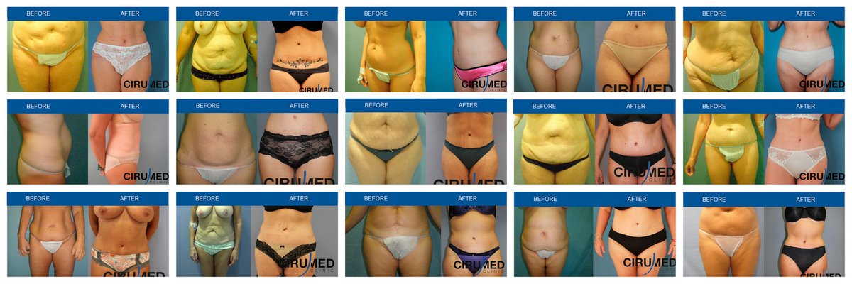 Cirumed Clinic Marbella - Cirumed Clinic Marbella