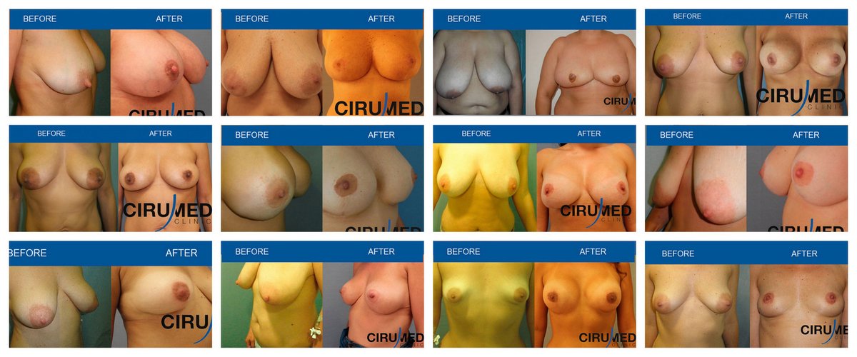 Cirumed Clinic Marbella - Cirumed Clinic Marbella