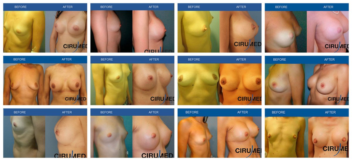 Cirumed Clinic Marbella - Cirumed Clinic Marbella