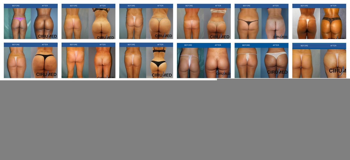 Cirumed Clinic Marbella - Cirumed Clinic Marbella