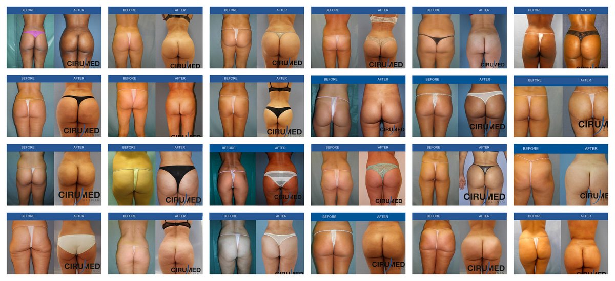 Cirumed Clinic Marbella - Cirumed Clinic Marbella