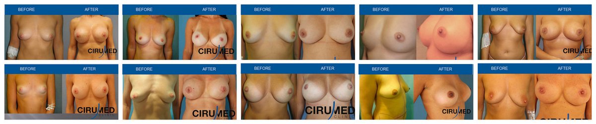 Cirumed Clinic Marbella - Cirumed Clinic Marbella