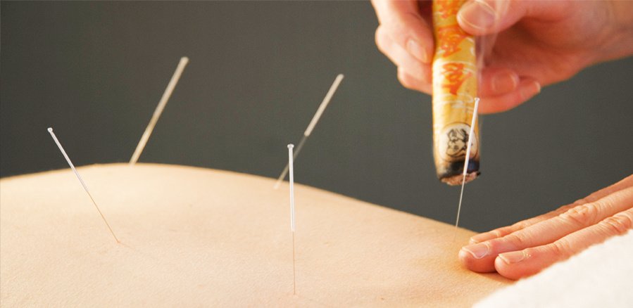 City College Acupuncture Clinic - City College Acupuncture Clinic
