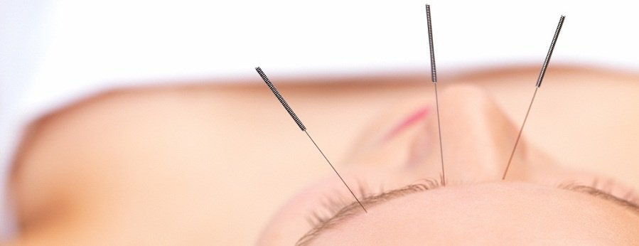 City College Acupuncture Clinic - City College Acupuncture Clinic