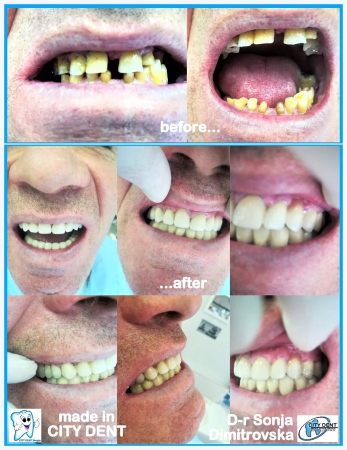 City Dent - City Dent