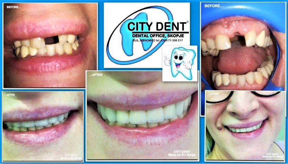 City Dent - City Dent