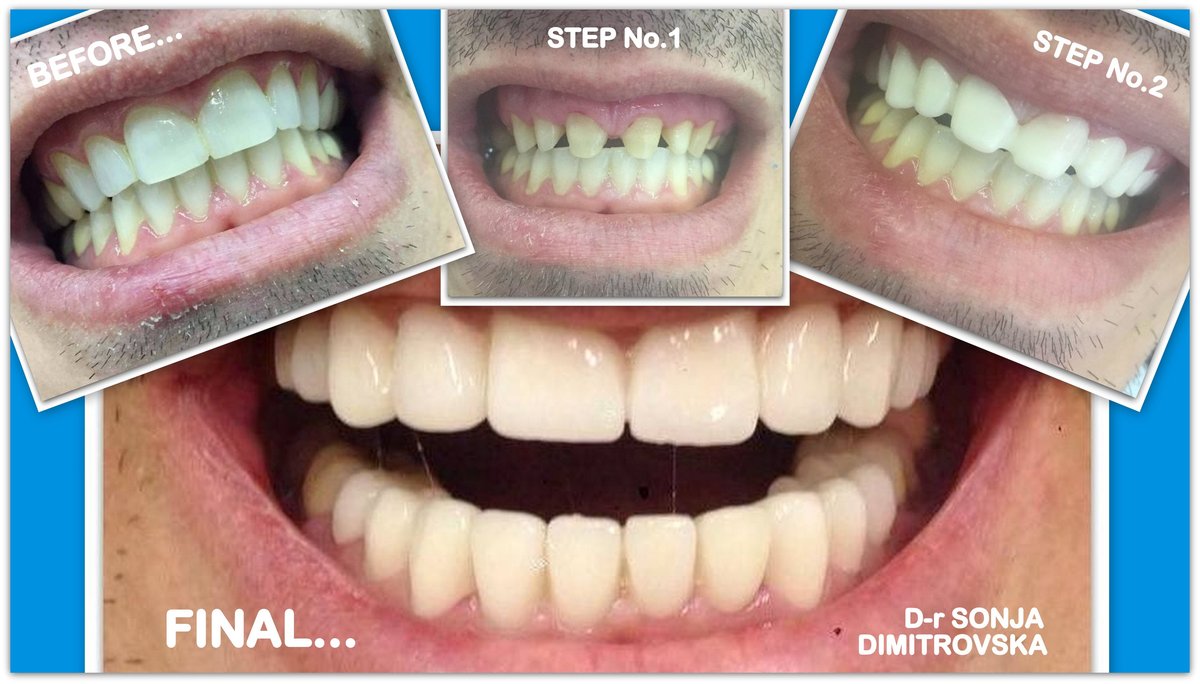 City Dent - City Dent