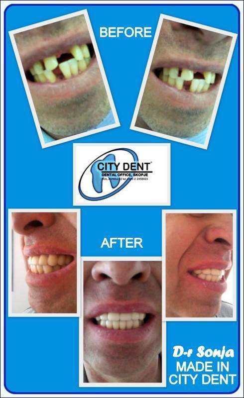 City Dent - City Dent